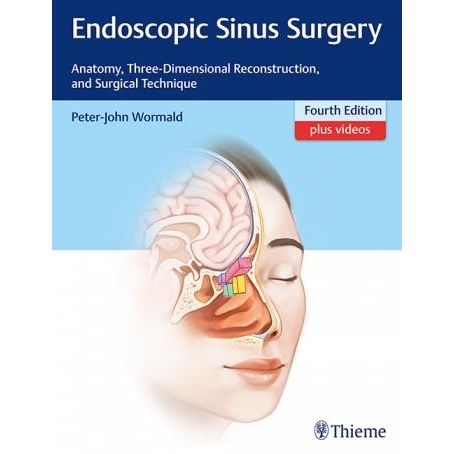 Wormald Endoscopic Sinus Surgery 4th edition