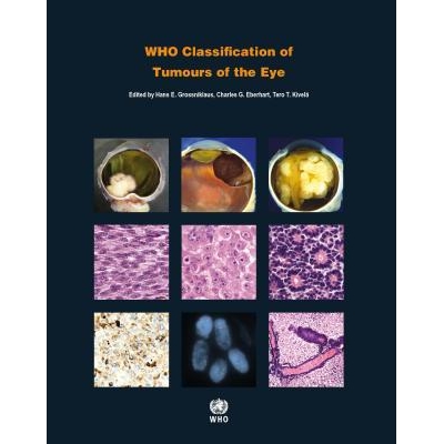 WHO Classification of Tumours of the Eye : WHO Classification of Tumours, Volume 12, 4th Edition