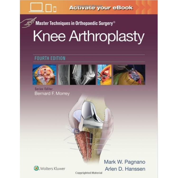 Master Techniques in Orthopedic Surgery: Knee Arthroplasty, 4th Edition