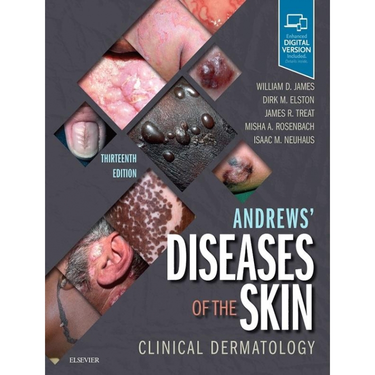Andrews` Diseases of the Skin, 13th Edition