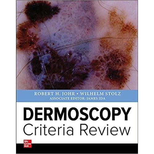 Dermoscopy Criteria Review