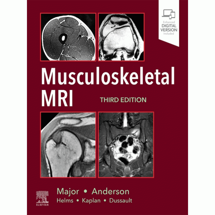 Musculoskeletal MRI, 3rd Edition