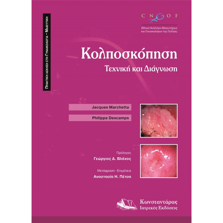 Κολποσκόπηση Τεχνική και Διάγνωση