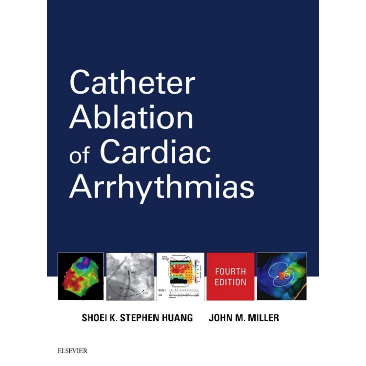 Catheter Ablation of Cardiac Arrhythmias, 4th Edition