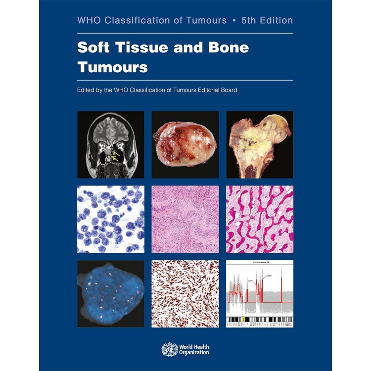 Soft Tissue and Bone Tumours: WHO Classification of Tumours, 5th Edition