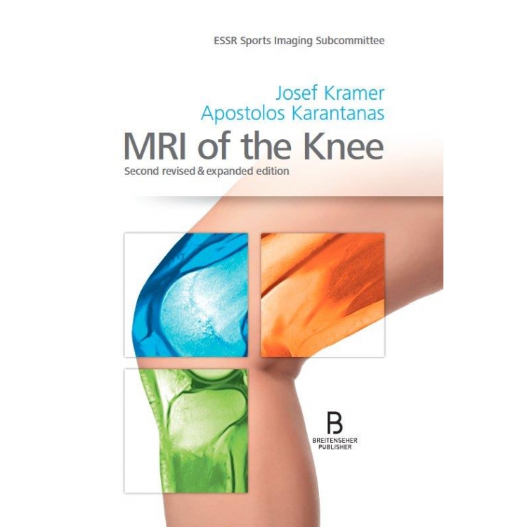 MRI of the Knee, 2nd Edition