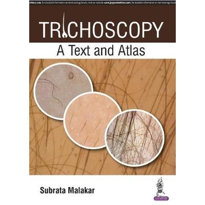 Trichoscopy : A Text and Atlas