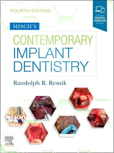 Misch`s Contemporary Implant Dentistry 4th Edition