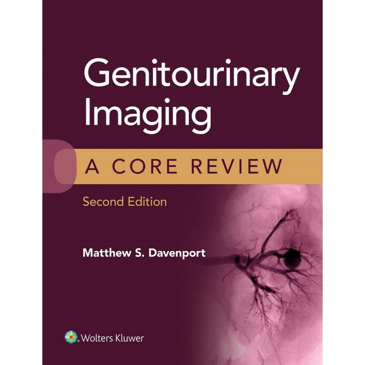 Genitourinary Imaging: A Core Review, 2nd Edition