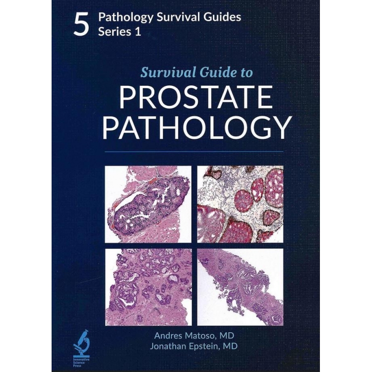 Survival Guide to Prostate Pathology