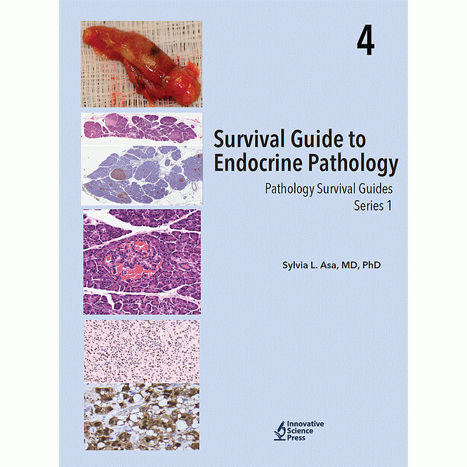 Survival Guide to Endocrine Pathology