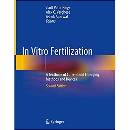 In Vitro Fertilization