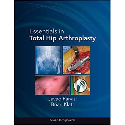 Essentials in Total Hip Arthroplasty