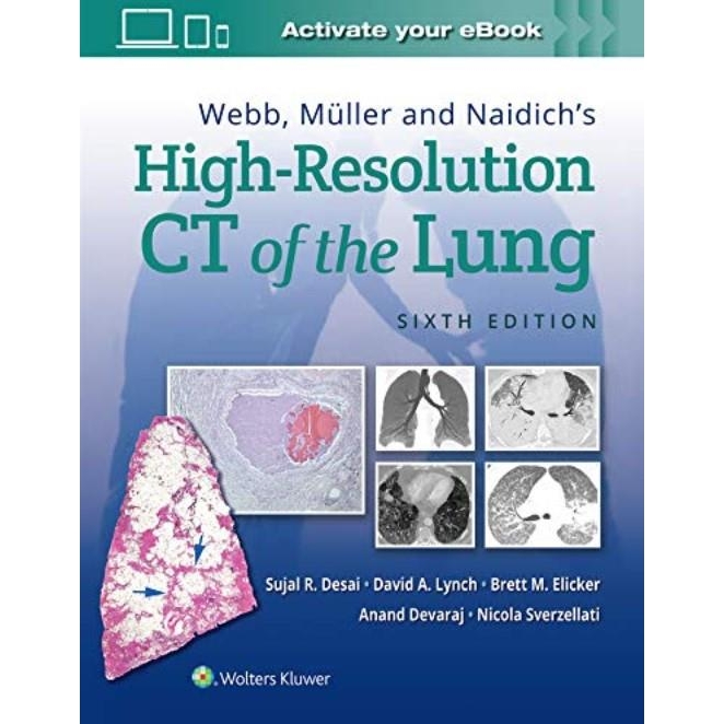 Webb, Muller and Naidich`s High-Resolution CT of the Lung 6th edition