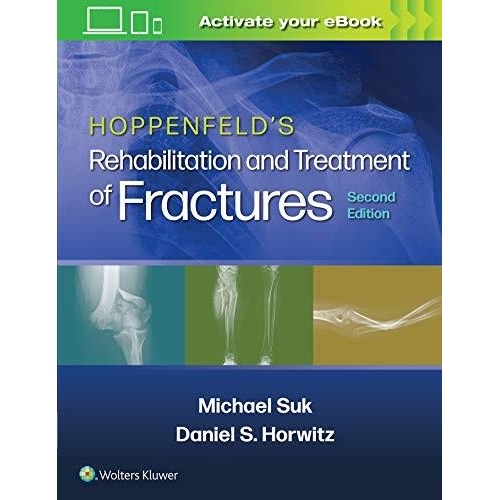 Hoppenfeld`s Treatment and Rehabilitation of Fractures, 2nd Edition