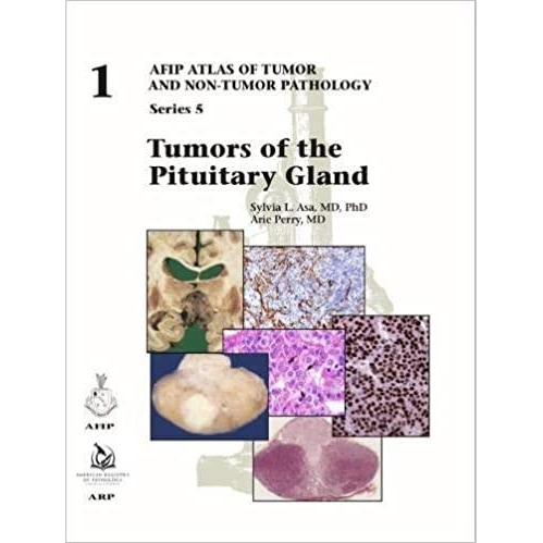 Tumors of the Eye and Ocular Adnexa (AFIP Atlases of Tumor and Non-Tumor Pathology, Series 5)