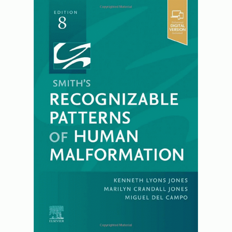 Smith`s Recognizable Patterns of Human Malformation, 8th Edition