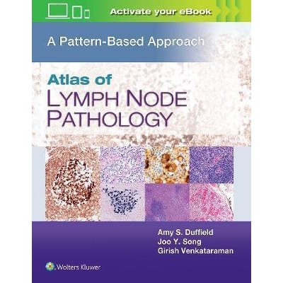Atlas of Lymph Node Pathology A Pattern Based Approach, First edition