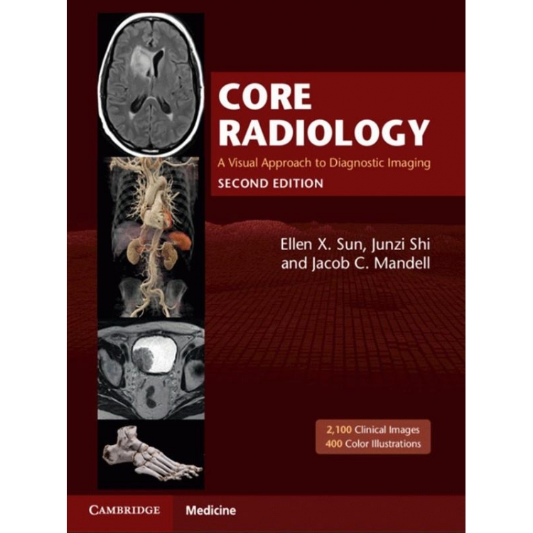Core Radiology: A Visual Approach to Diagnostic Imaging, 2nd Edition