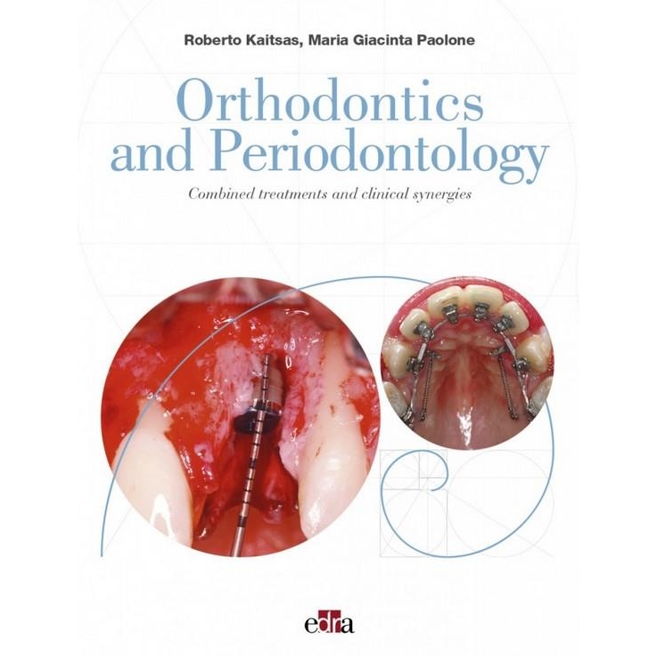 Orthodontics and Periodontology: Combined treatments and clinical synergies