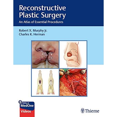 Reconstructive Plastic Surgery: An Atlas of Essential Procedures 1st Edition