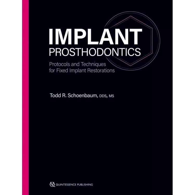 Implant Prosthodontics Protocols and Techniques for Fixed Implant Restorations