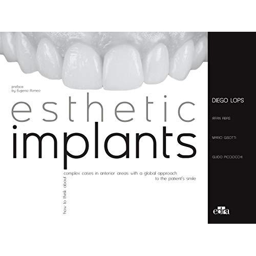 Esthetic Implants How to think about complex cases in anterior areas with a global approach to the patient smile 1st Edition