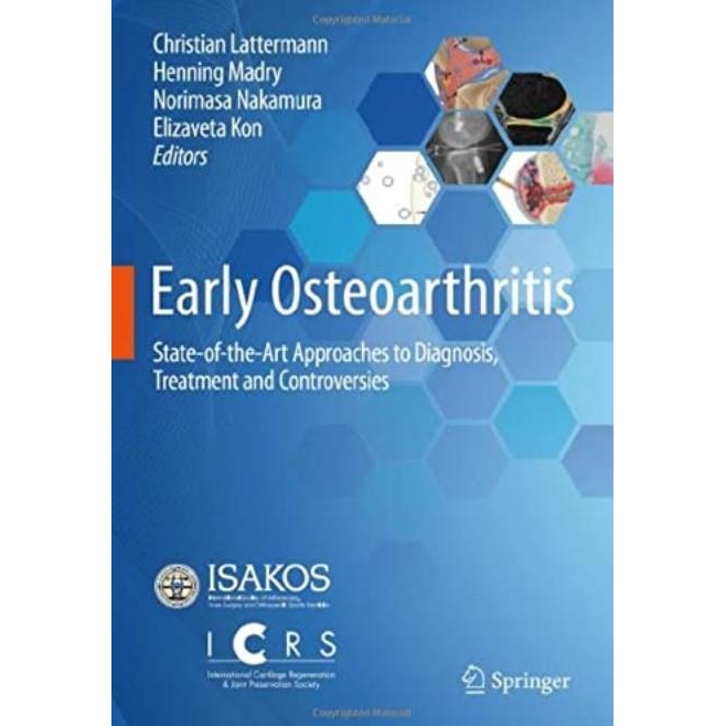 Early Osteoarthritis: State-of-the-Art Approaches to Diagnosis, Treatment and Controversies