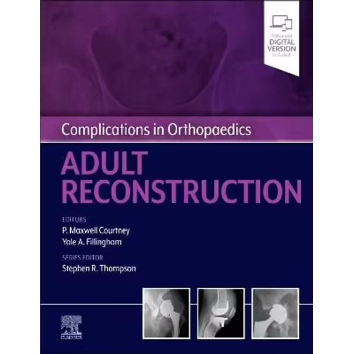 Complications in Orthopaedics: Adult Reconstruction, 1st Edition