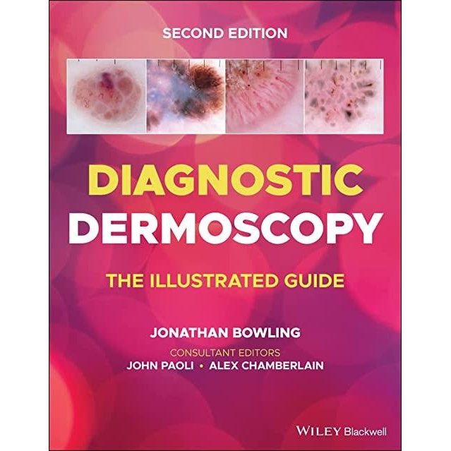 Diagnostic Dermoscopy The Illustrated Guide, 2nd Edition