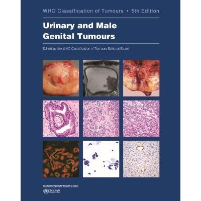WHO Classification of Tumours Urinary and Male Genital Tumours, 5th Edition, Volume 8