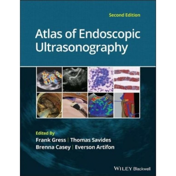 Atlas of Endoscopic Ultrasonography, 2nd Edition