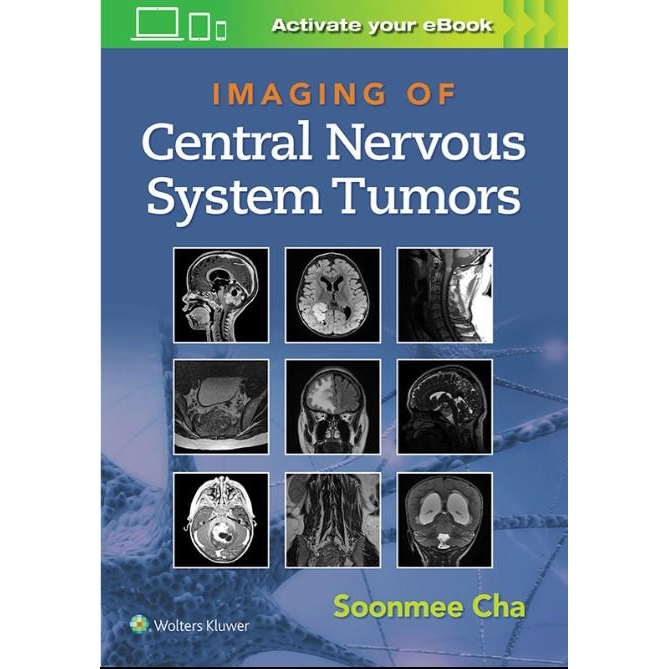 Imaging of Central Nervous System Tumors First edition