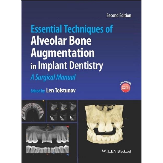 Essential Techniques of Alveolar Bone Augmentation, 2nd Edition