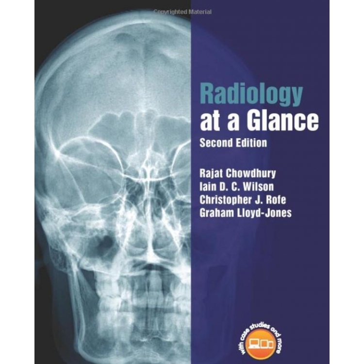 Radiology at a Glance 2nd Edition