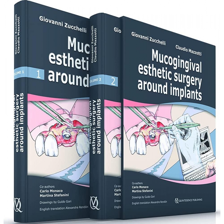 Mucogingival Esthetic Surgery around Implants, 1st Edition