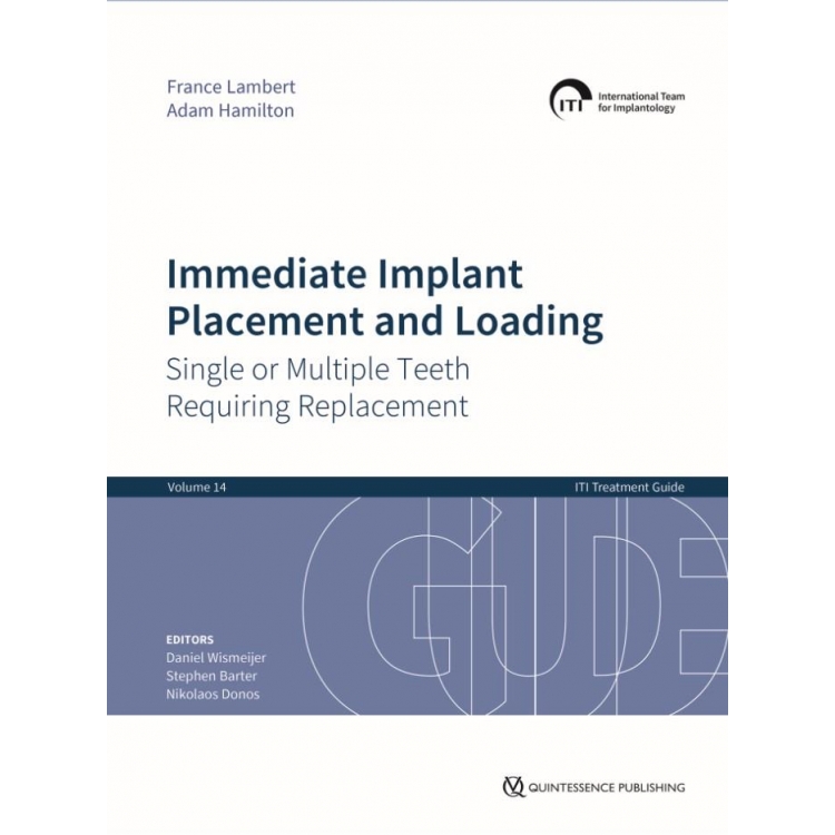 Immediate Implant Placement and Loading – Single or Multiple Teeth Requiring Replacement, 1st Edition