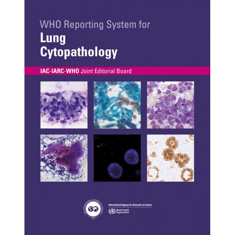 WHO Reporting System for Lung Cytopathology