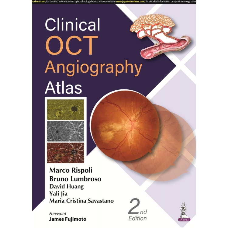 Clinical OCT Angiography Atlas, 2nd Edition