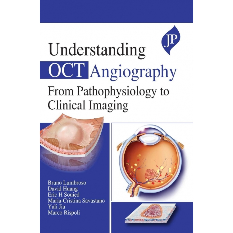 Understanding OCT Angiography  From Pathophysiology to Clinical Imaging, 1st Edition