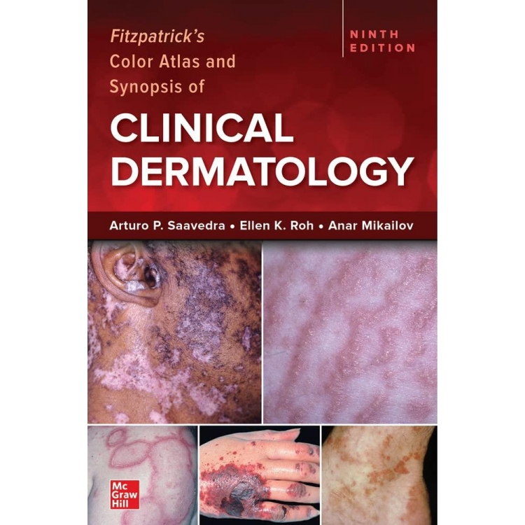 Fitzpatrick`s Color Atlas and Synopsis of Clinical Dermatology, 9th Edition, IE