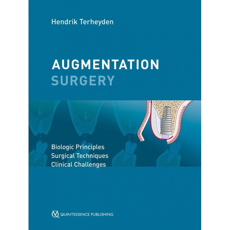 Augmentation Surgery: Biologic Principles | Surgical Techniques | Clinical Challenges, 1st Edition