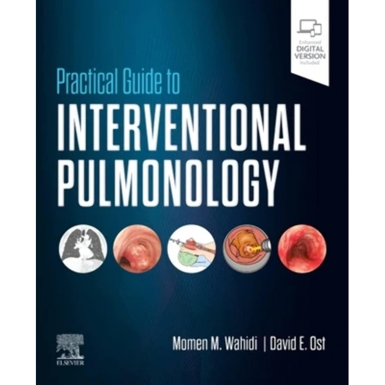Practical Guide to Interventional Pulmonology, 1st Edition