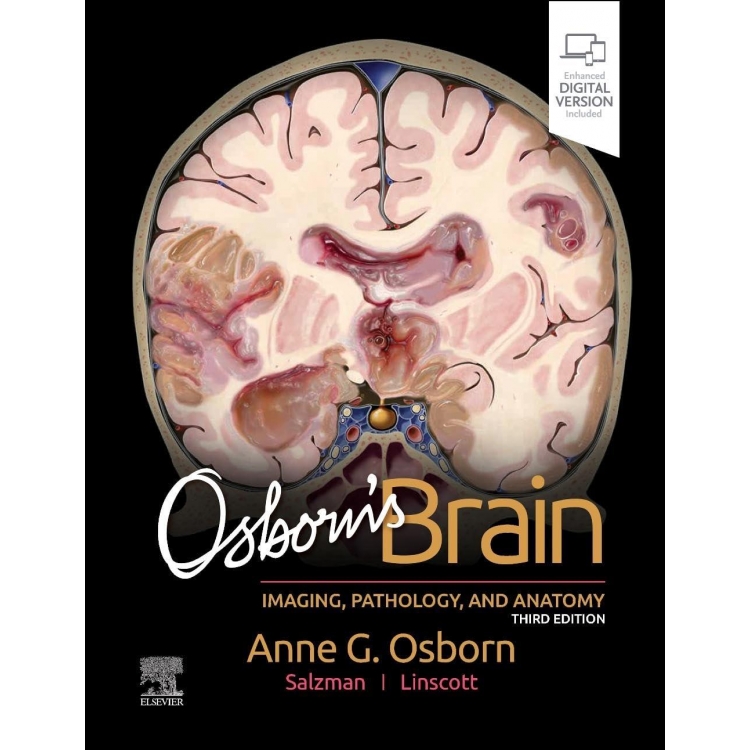 Osborn`s Brain, 3rd Edition