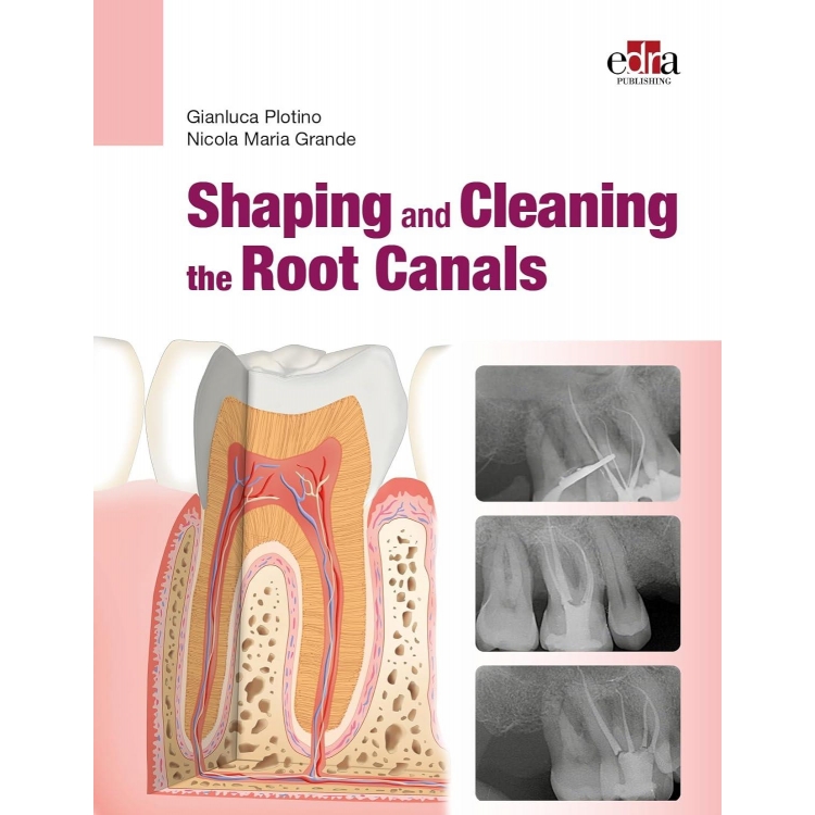 Shaping and Cleaning the Root Canals, 1st Edition