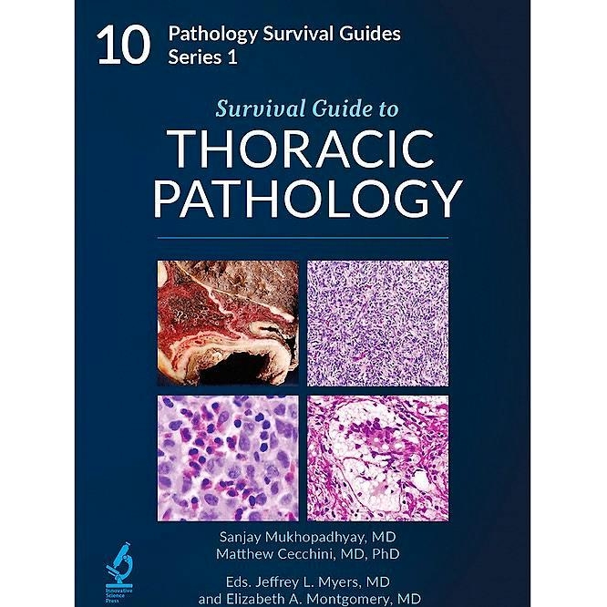Survival Guide to Thoracic Pathology SG10