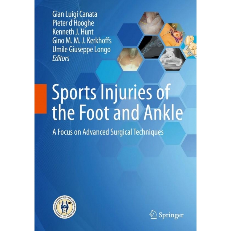 Sports Injuries of the Foot and Ankle: A Focus on Advanced