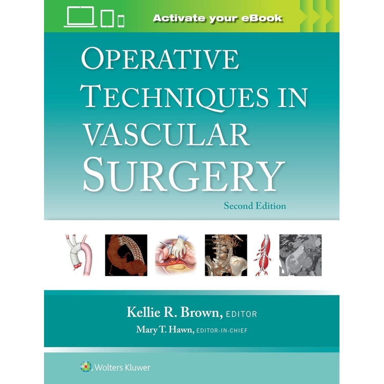 Operative Techniques in Vascular Surgery Second edition