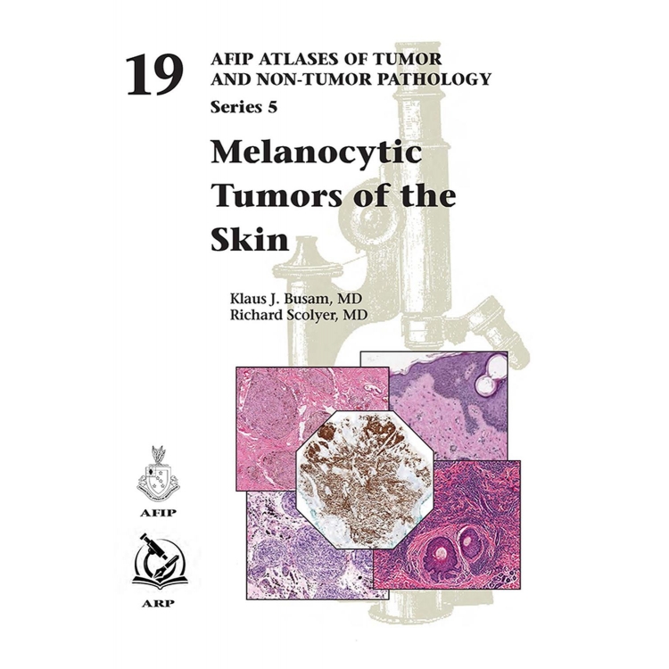 Melanocytic Tumors of Skin Atlases of Tumor and Non-Tumor Pathology, Series 5