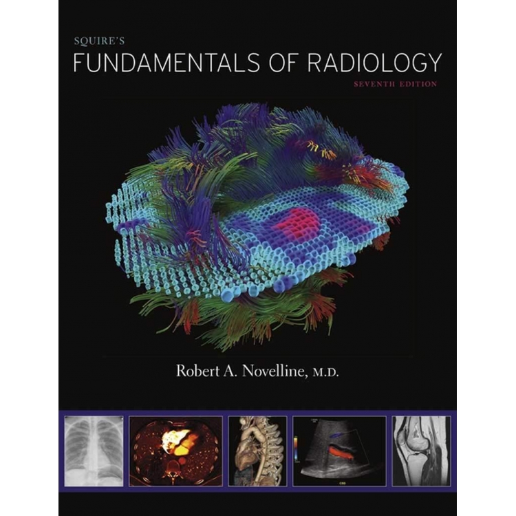 Squire’s Fundamentals of Radiology, 7th Edition